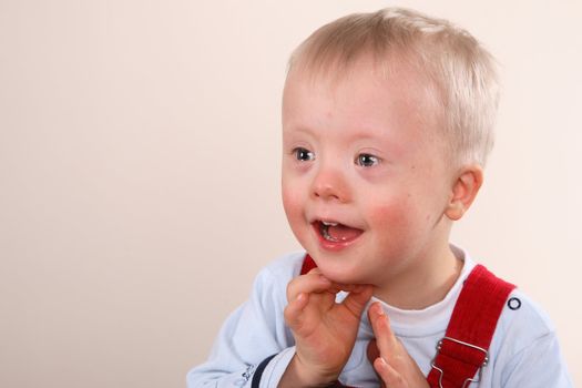 Young Boy with special needs, possibly Downs Syndrome