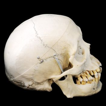 Real human skull with hinged jaw and removable skullcap.  Side view.