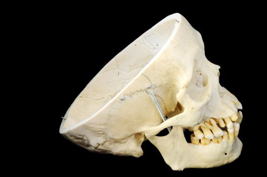 Real human skull with hinged jaw and removable skullcap.  Side view.