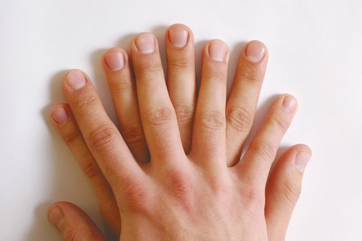 Two men's hands with tangled fingers