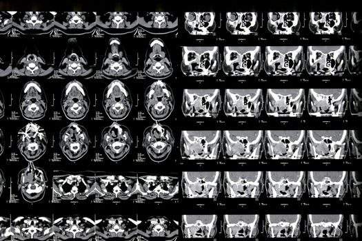 details Magnetic resonance of a brain