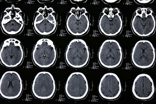 details Magnetic resonance of a brain