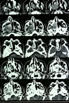 details Magnetic resonance of a brain