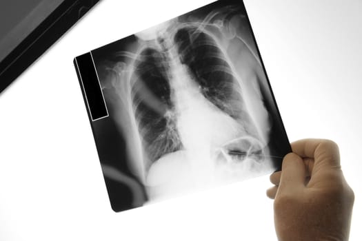 Doctor holding an x-ray image, medical image