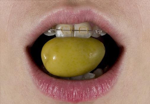 A green olive about to be eaten for a woman with braces.