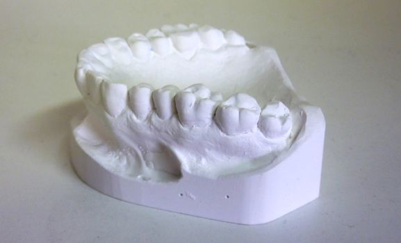 White plaster teeth for dental technician
