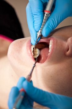 Dentist checking the mouth of her patient for cavities