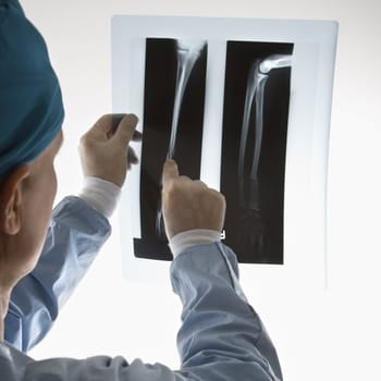 Mid-adult Caucasian male doctor pointing at an x-ray.