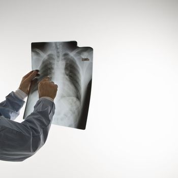 Mid-adult Caucasian male doctor pointing at an x-ray.
