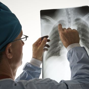 Mid-adult Caucasian male doctor pointing at a bone on a x-ray.