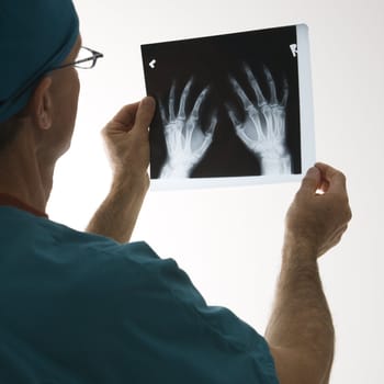 Mid-adult Caucasian male doctor holding an x-ray.