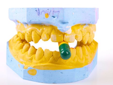 teeth plaster cast