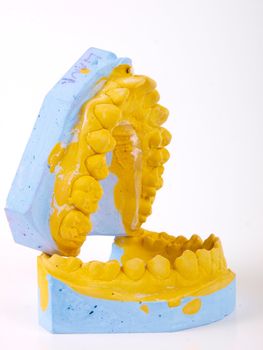 teeth plaster cast