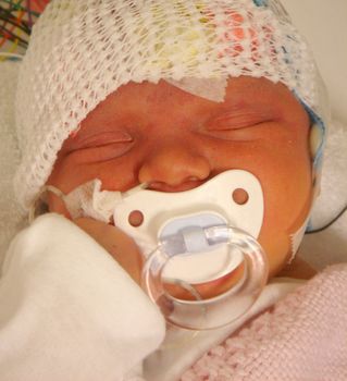 Newborn baby getting a full EEG (brain wave scan). Head is covered by sensors, wires vivible in the background. 