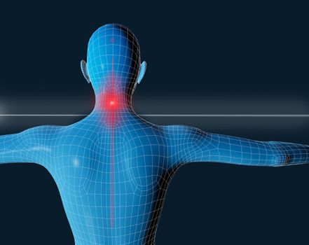 3d image of a man on your back with neck pain