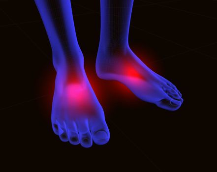 3d image of feet with  red pain