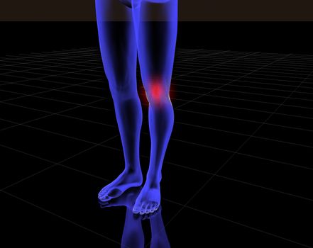 3d image of x-ray of legs  with red pain in the knee