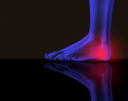 x-ray of a foot with red pain