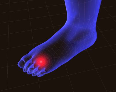 3d image of feet with pain 