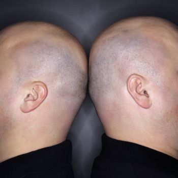 Close up of Caucasian mid adult identical twin bald men standing back to back.