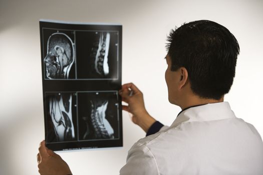 Asian American male doctor examining x-rays.