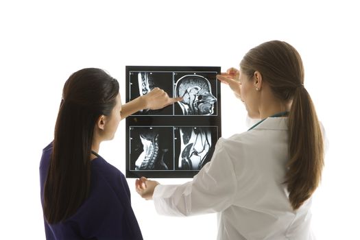 Caucasian and Asian Chinese mid-adult female doctors analyzing x-ray.