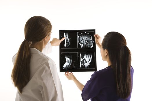 Caucasian and Asian Chinese mid-adult female doctors analyzing x-ray.