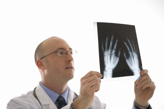 Caucasian mid adult male physician holding up hand xrays.