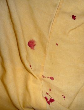 Blood on bedsheets caused by a nosebleed.
