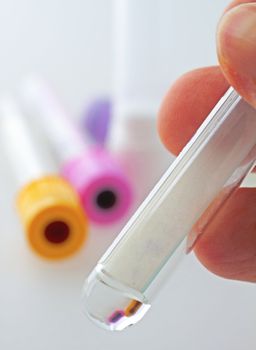 Male hand holding a test tube, with others on the background