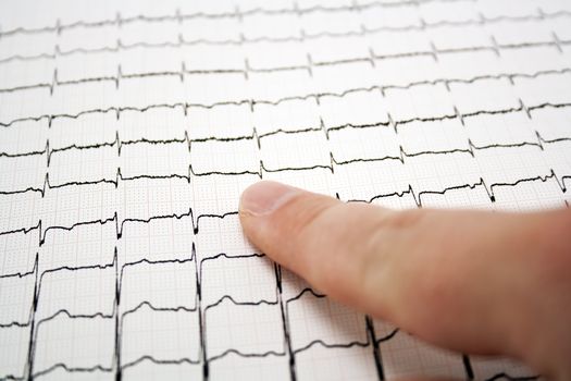 Doctor analyzing ECG - EKG graph