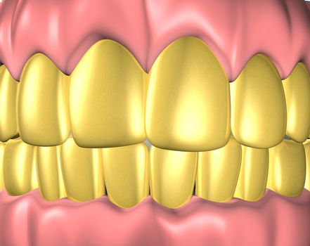 3d image of teeth with gold teeth