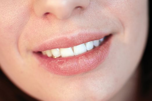 Shot of beautiful young girl with dry lips smiling