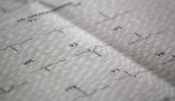 Design of a medical electrocardiogram on a paper