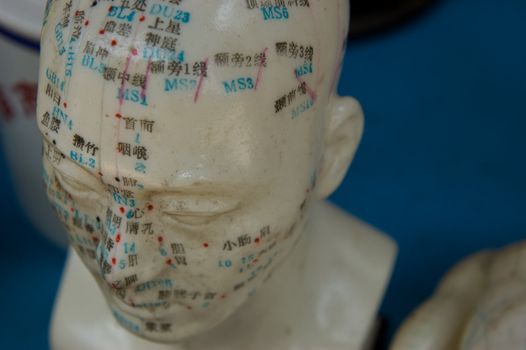 Model of acupuncture