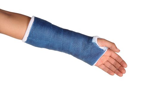 Blue cast on an arm of a child isolated on white background