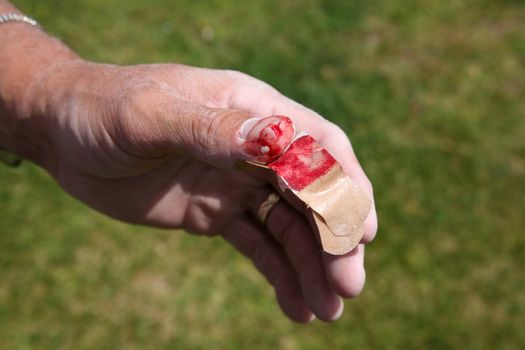 Construction worker with dusty hand and injured bloody thumb