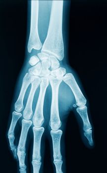 radiography of a middle aged woman