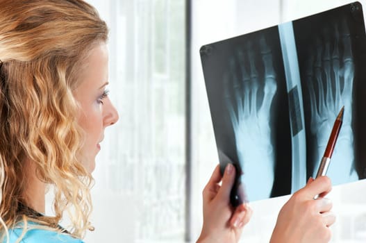 Medical doctor analysing x-ray photography in hospital