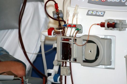 a dialysis machine in the renal unit of a hospital 