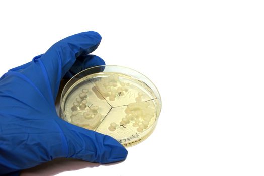 hand in glove shoving microbiological plate