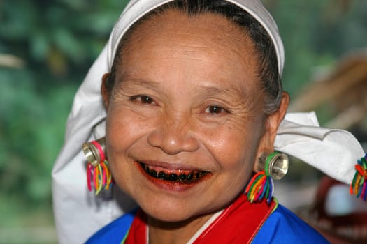 Woman of the Black Karen tribe with black teeth caused by chewing beetlenut leaves