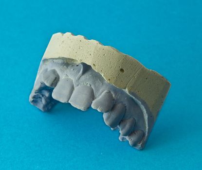 Plaster model of teeth on a blue background