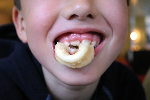 Boy Eating Calimari