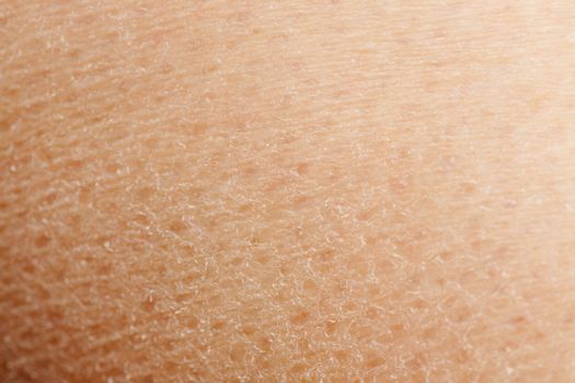 A macro detail background of dry skin