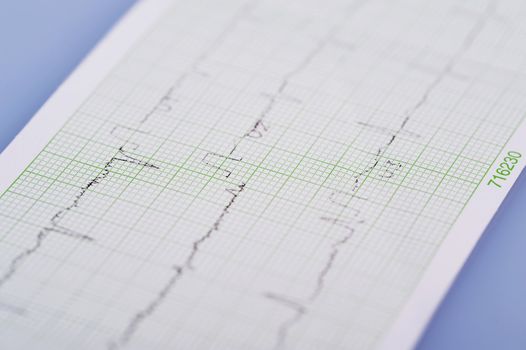 EKG, electrical activity of the heart in close up