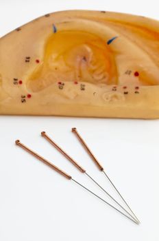 acupuncture needles for ear