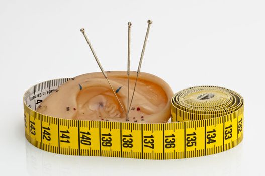 acupuncture for weight loss