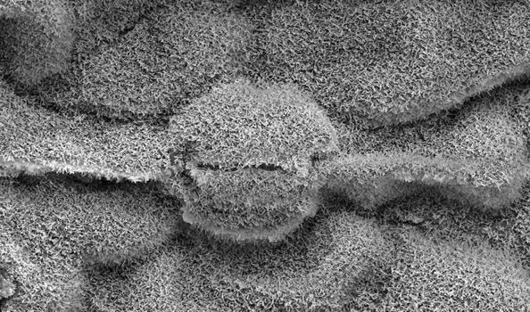 A leaf magnified 800 times in a electron microscope, the breathing organs of the leaf (stomata) are in the center of the picture.