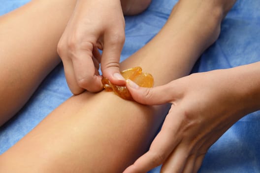 Sugaring: epilation with liquate sugar at legs.